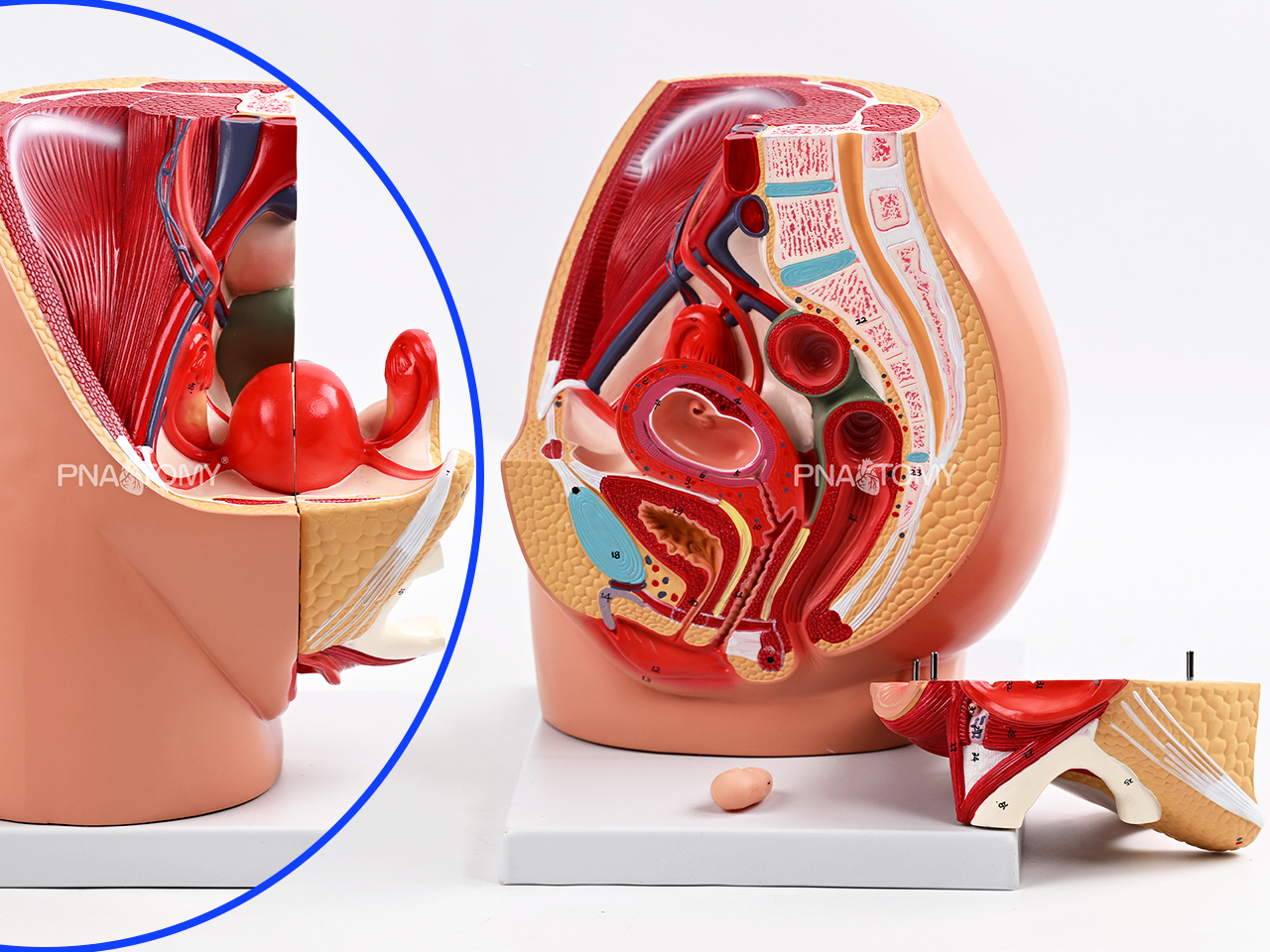 It's a great technology.