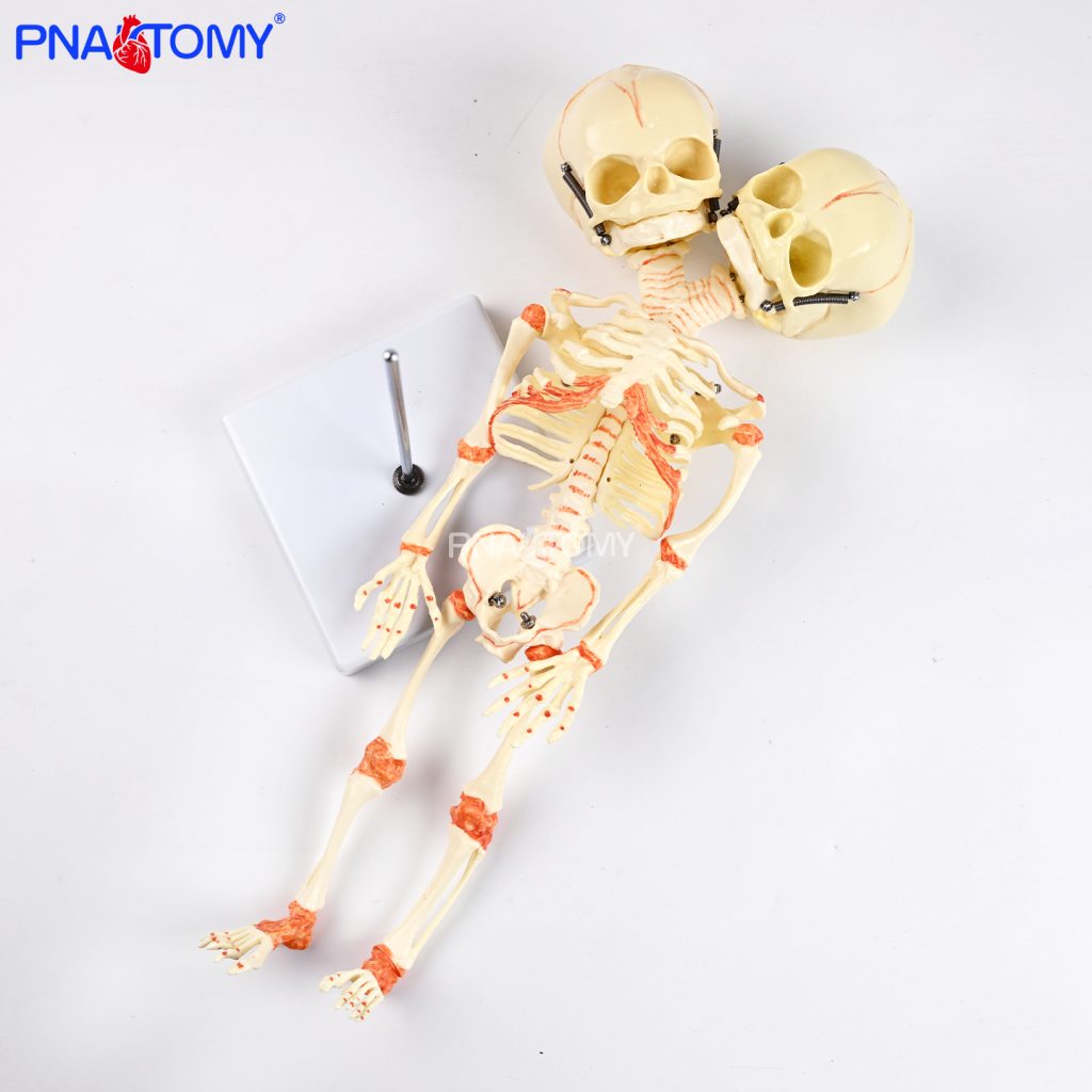 Two-headed baby bones.