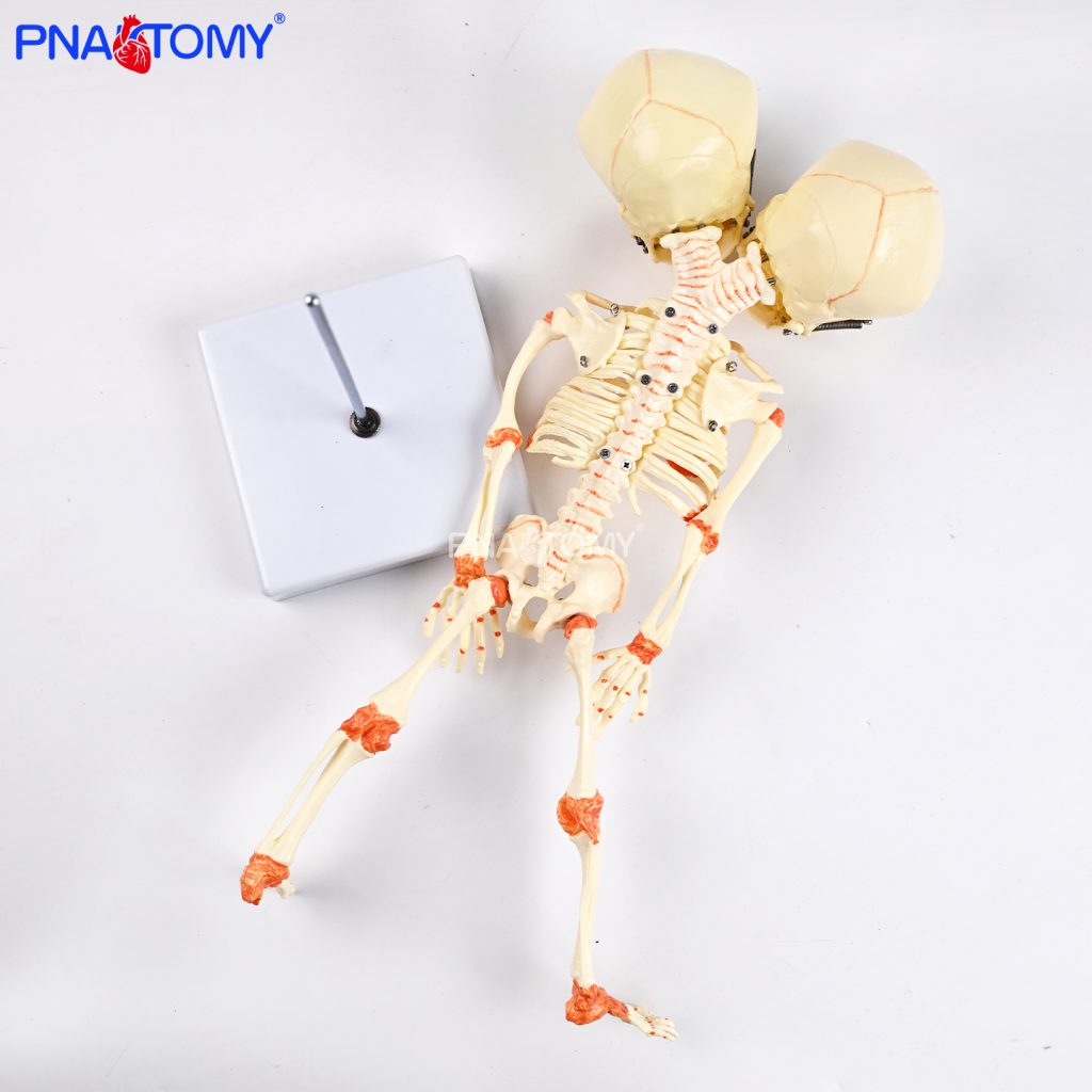 Two-headed baby bones.