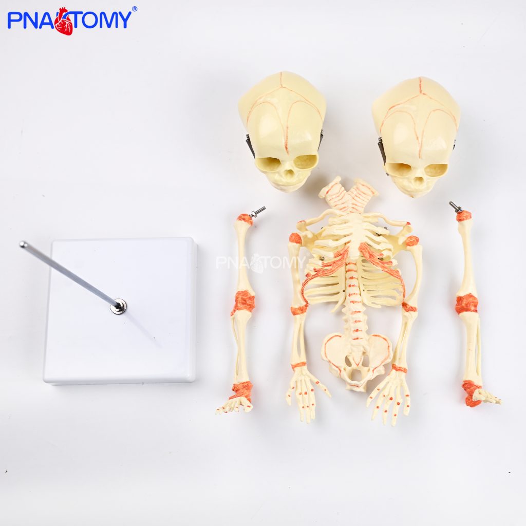 Two-headed baby bones.
