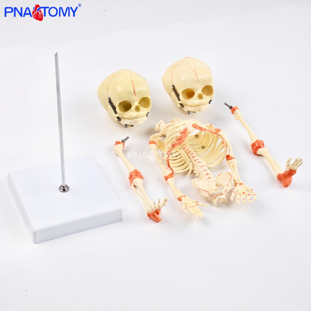 Two-headed baby bones.