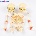 Two-headed baby bones.