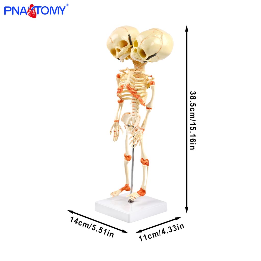 Two-headed baby bones.