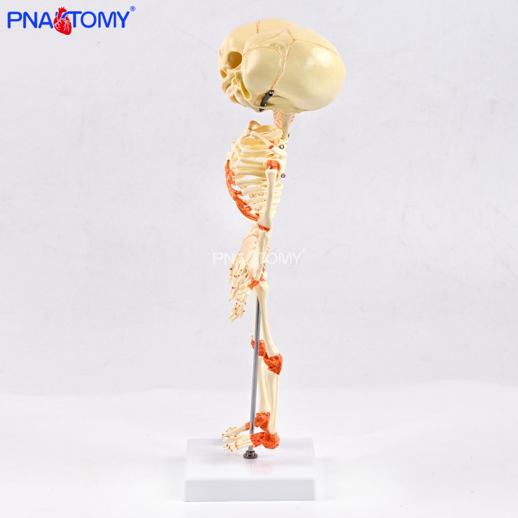 Two-headed baby bones.