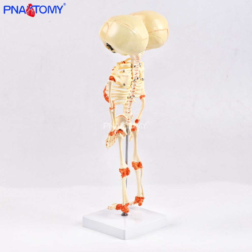 Two-headed baby bones.