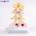 三节腰椎带病变椎间盘
