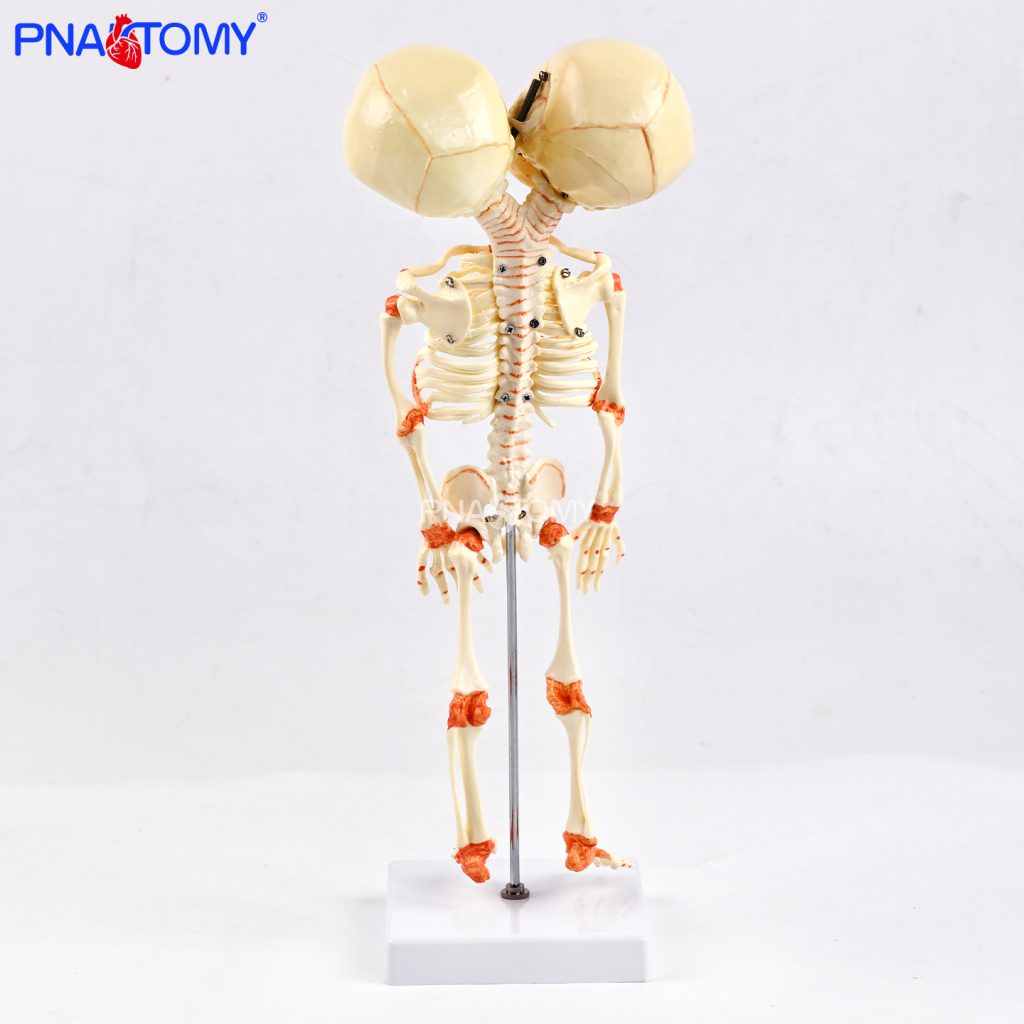 Two-headed baby bones.