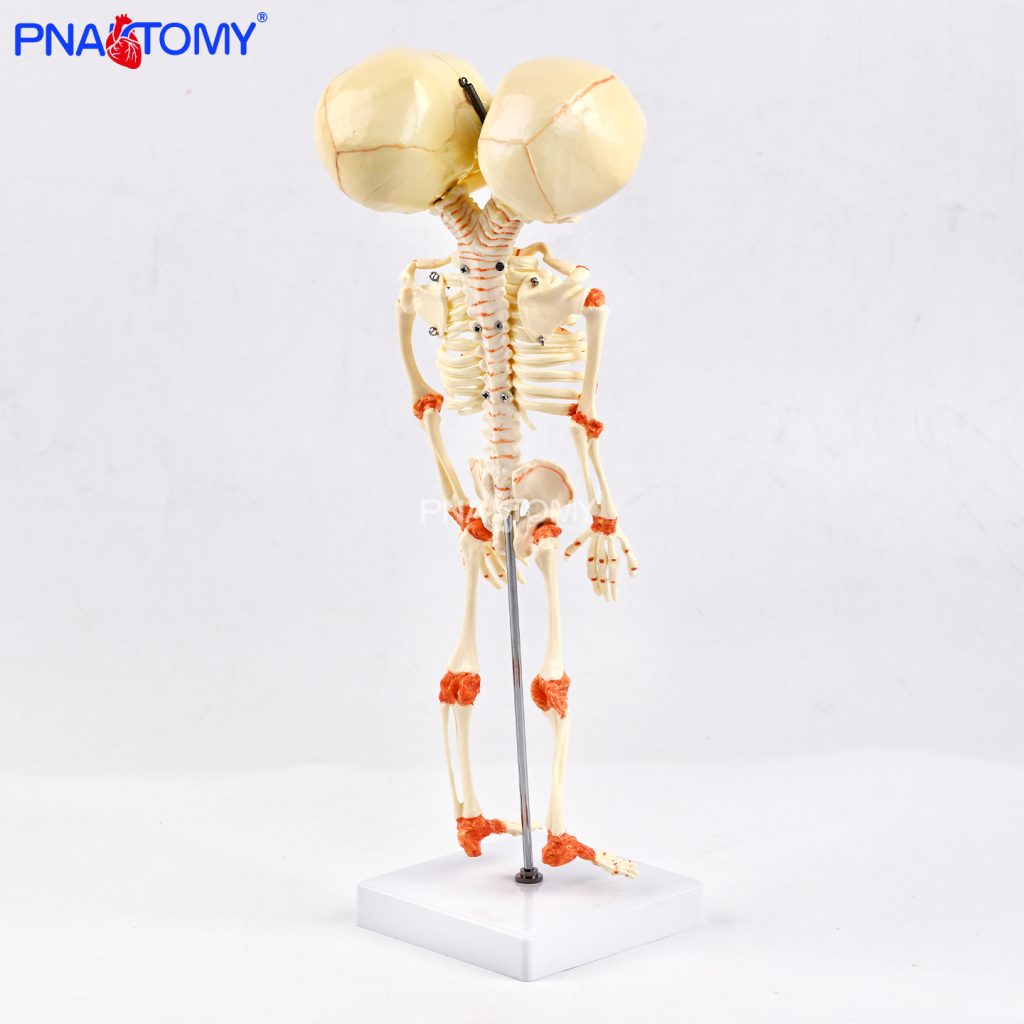 Two-headed baby bones.