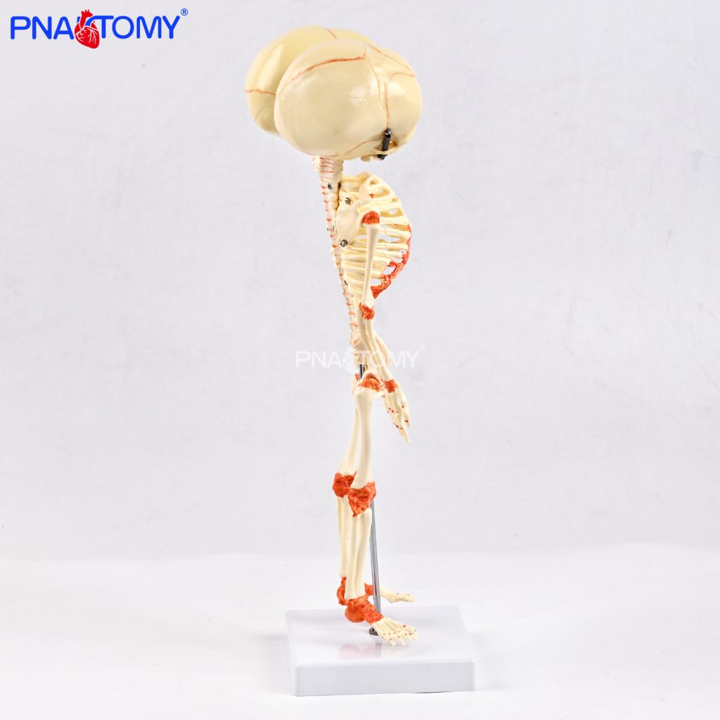 Two-headed baby bones.