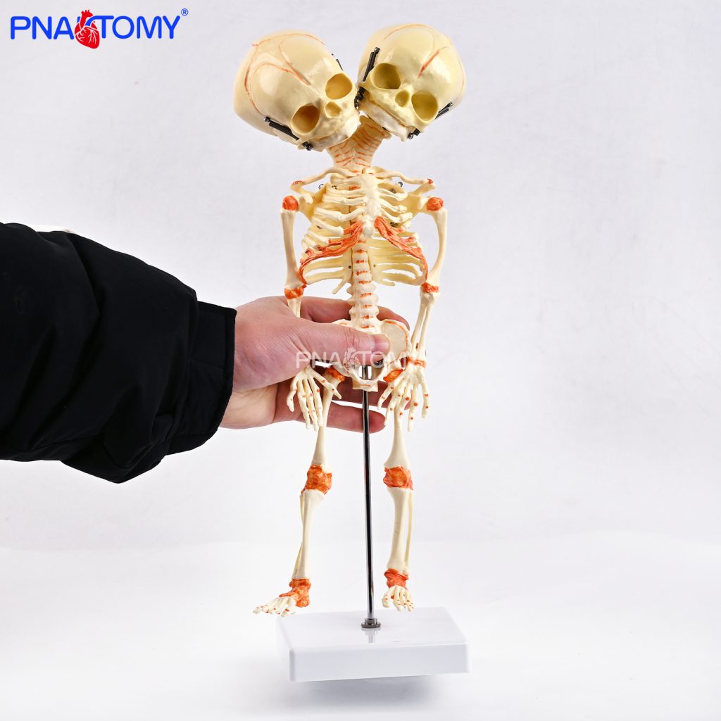 Two-headed baby bones.