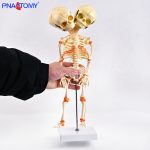 Two-headed baby bones.